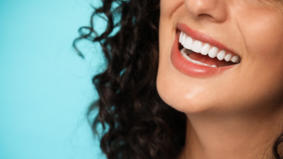 5 myths about teeth whitening